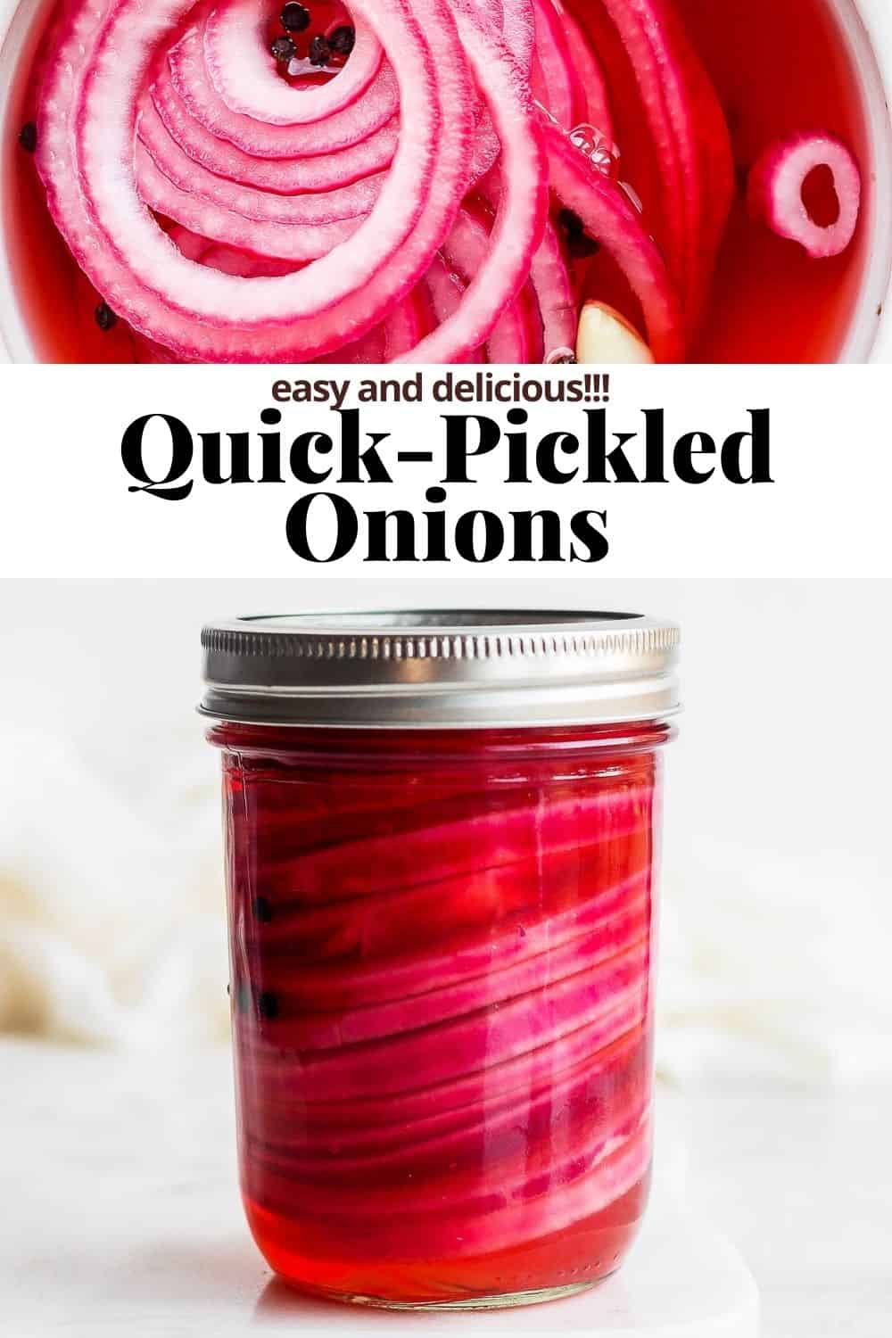 Pinterest image for quick pickled onions.